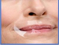 Pacht levres et contour de la bouche