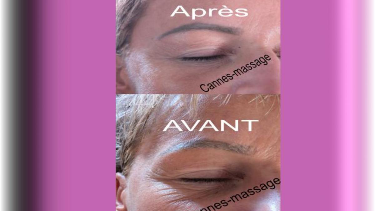 Soin du visage ( Anti rides )