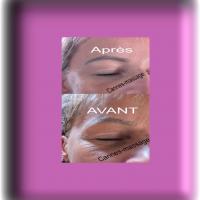 Soin du visage